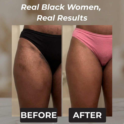 Rennora Dark Spot Remover