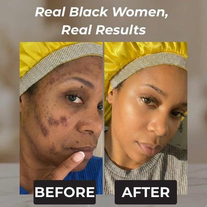 Rennora Dark Spot Remover